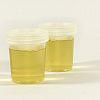 Sekilas Tentang Urine